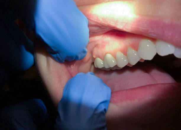 Best Emergency Dentist for Knocked-Out Tooth in Lake Village, AR